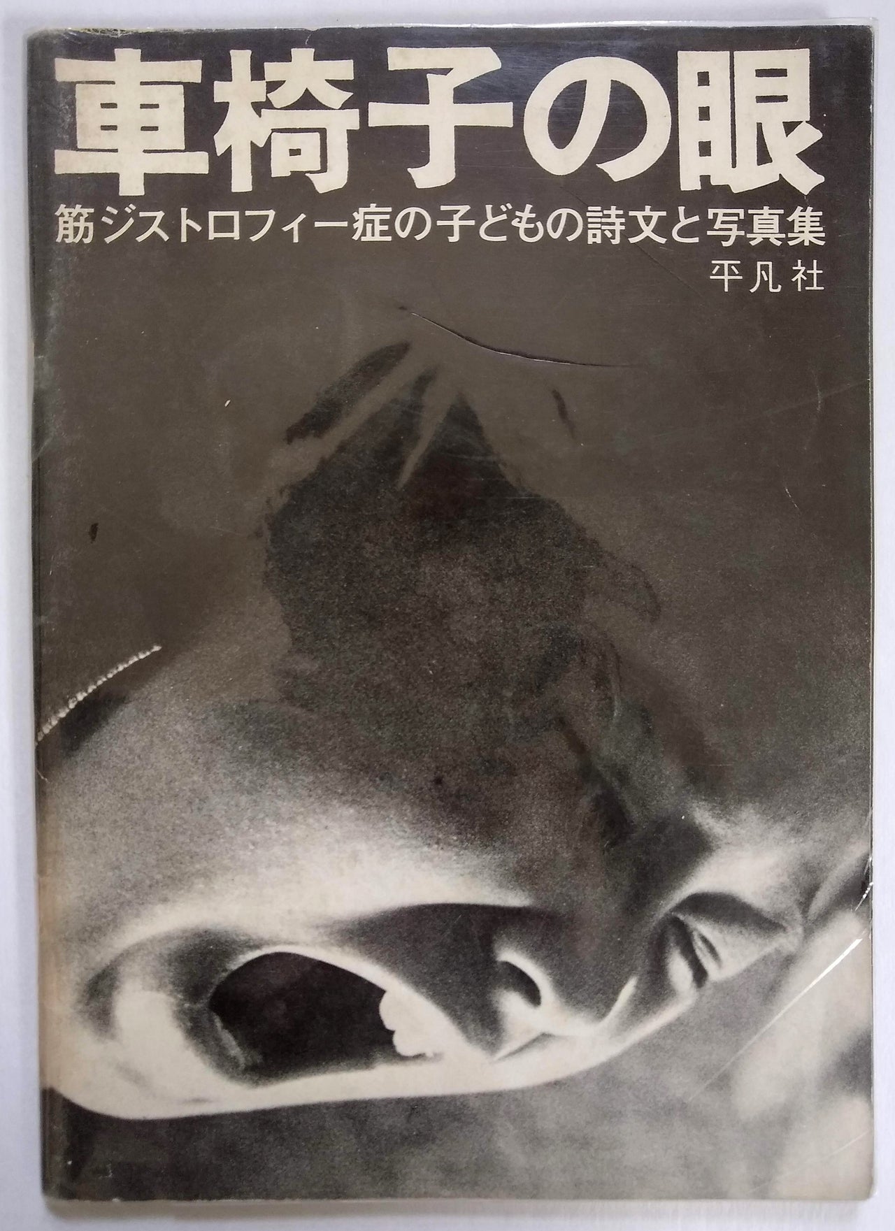 Kurumaisu no me: Suji jisutorofī-shō no kodomo no shibun to shashin-shū [Photographs and poems by children with Muscular Dystrophy].